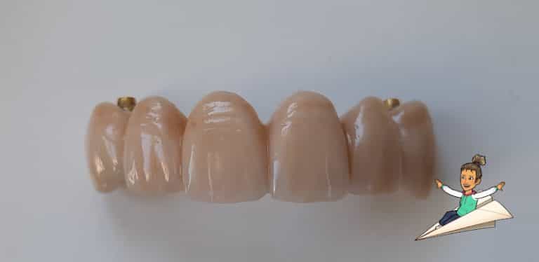 Dentaltec